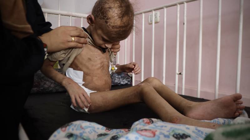 unrwa gazzede 3 yas alti her 3 cocuktan biri son 24 saati yiyeceksiz gecirdi IyhdaDbG